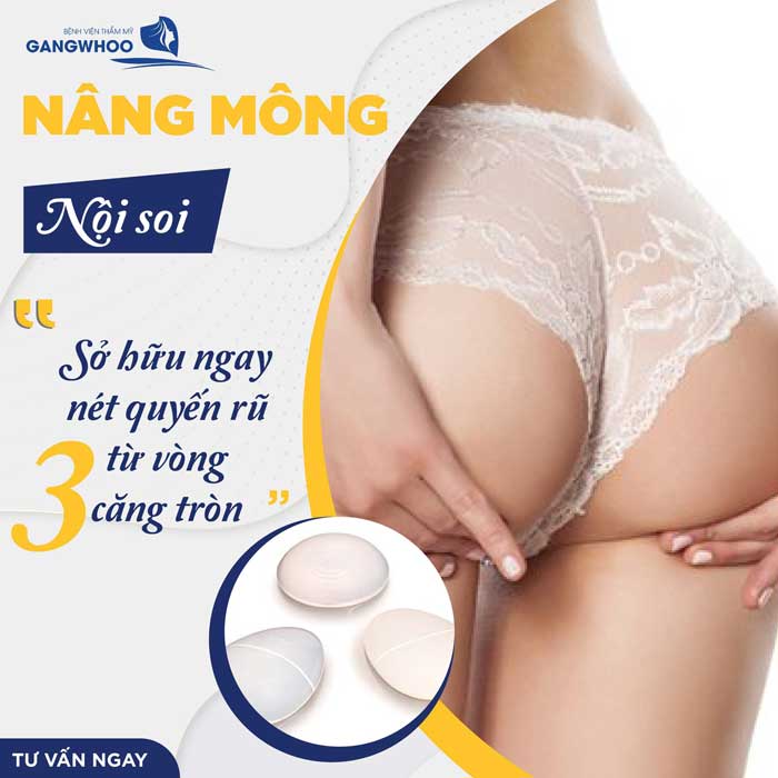 Giá nâng mông nội soi từ 70 - 100 triệu đồng