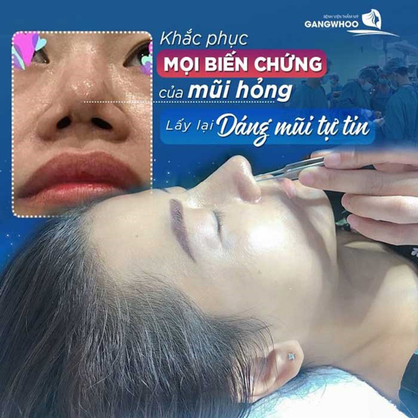 Bác sĩ Phùng Mạnh Cường: “Đôi tay vàng’’ xử lý những ca mũi hỏng