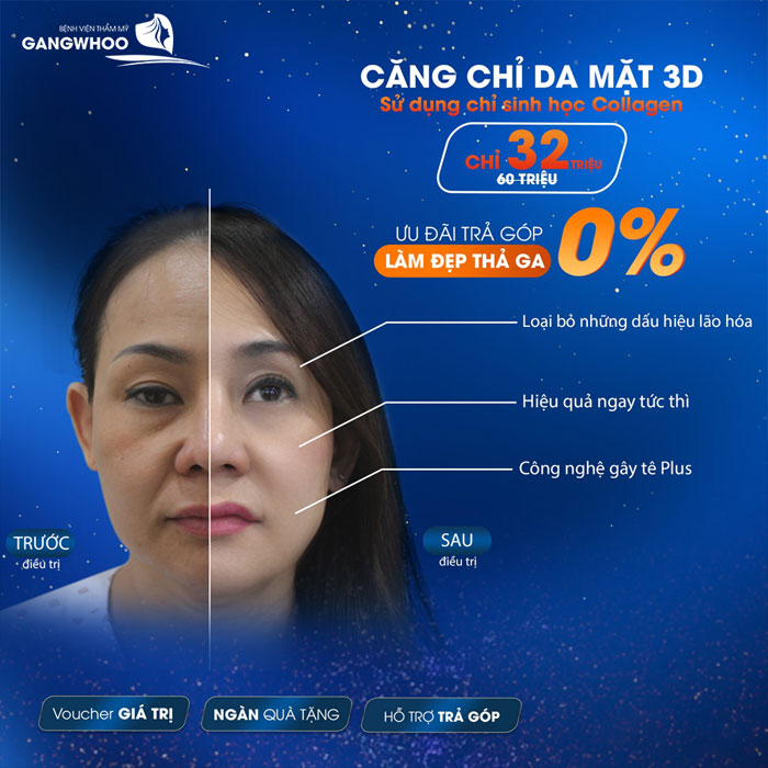 địa chỉ căng da mặt hiệu quả nhấtđịa chỉ căng da mặt hiệu quả nhất