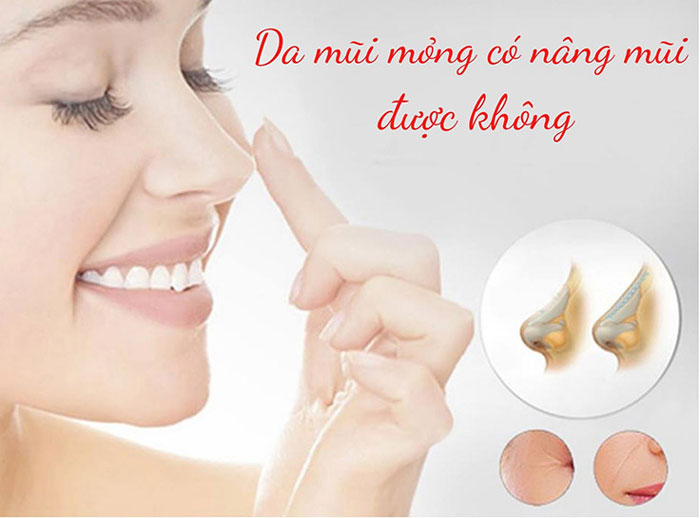 da mũi mỏng vẫn có thể nâng mũi bình thường