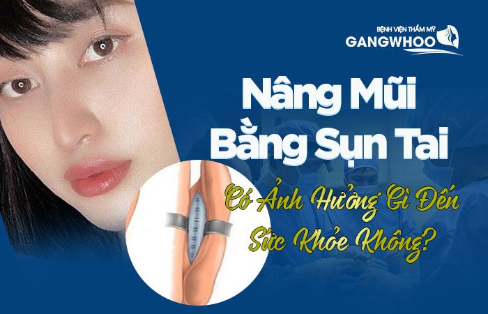 Nâng Mũi Bằng Sụn Tai Có Ảnh Hưởng Gì Đến Sức Khỏe Không?