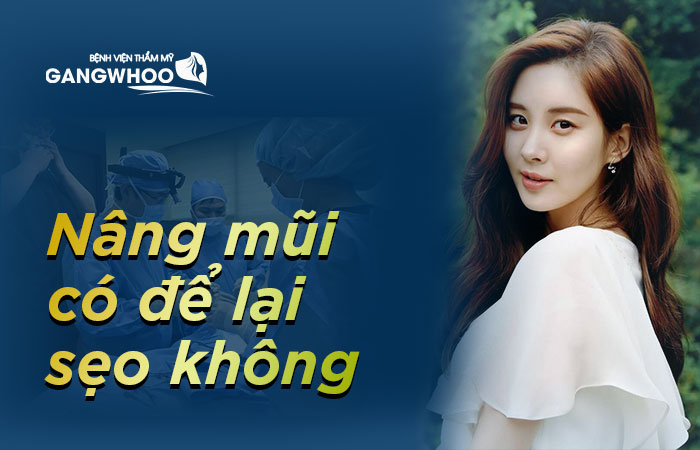 Nâng mũi có để lại sẹo không