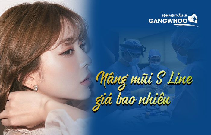 Nâng mũi S Line giá bao nhiêu tiền