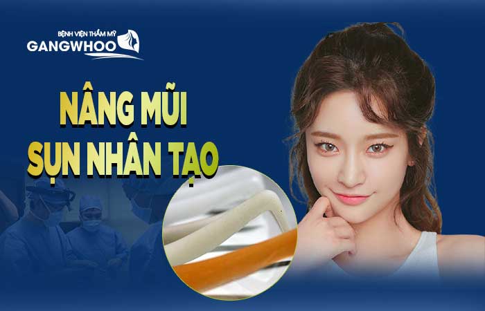 nâng mũi sụn nhân tạo