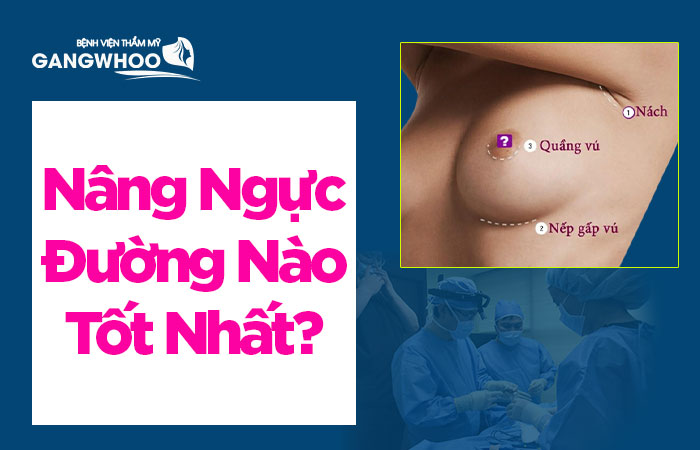 Nâng ngực qua đường nào tốt nhất?