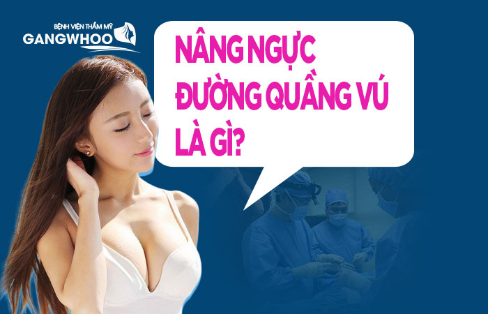 Nâng ngực qua đường quầng vú là gì?