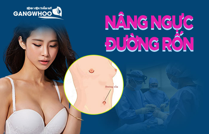 Nâng ngực qua đường rốn là gì