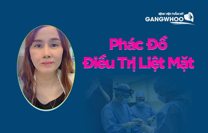 Phác đồ điều trị liệt mặt