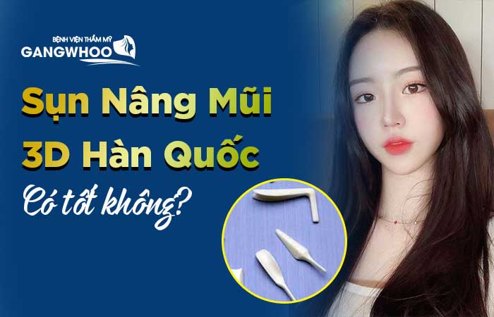 nâng mũi sụn 3D Hàn Quốc