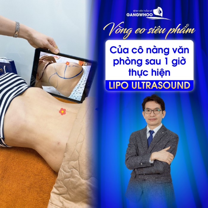 Có Nên Hút Mỡ Bụng Không? Bác Sĩ Review Địa Chỉ Hút Mỡ Bụng Uy Tín, Chất Lượng