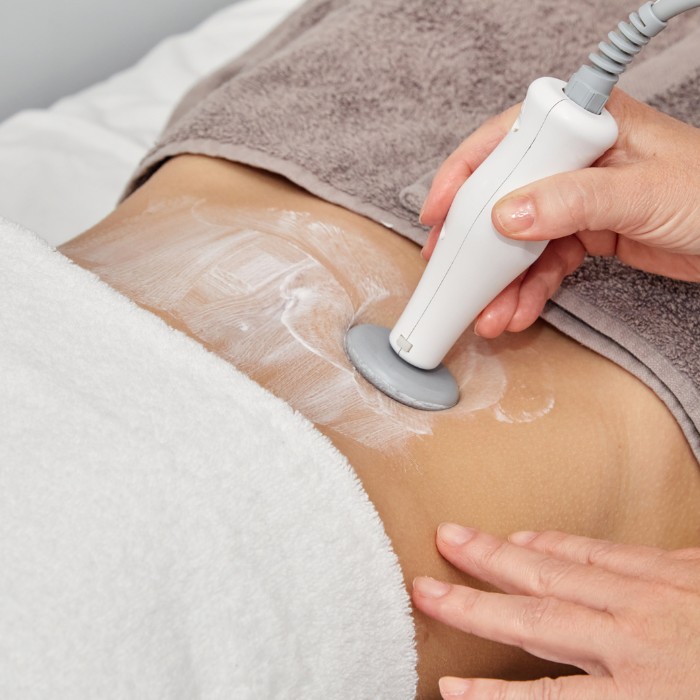 Hút mỡ bụng công nghệ mới nhất Cavitation