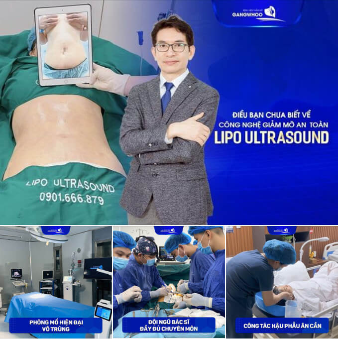 Hút mỡ Lipo Ultrasound - Công nghệ hút mỡ đến từ Hàn Quốc