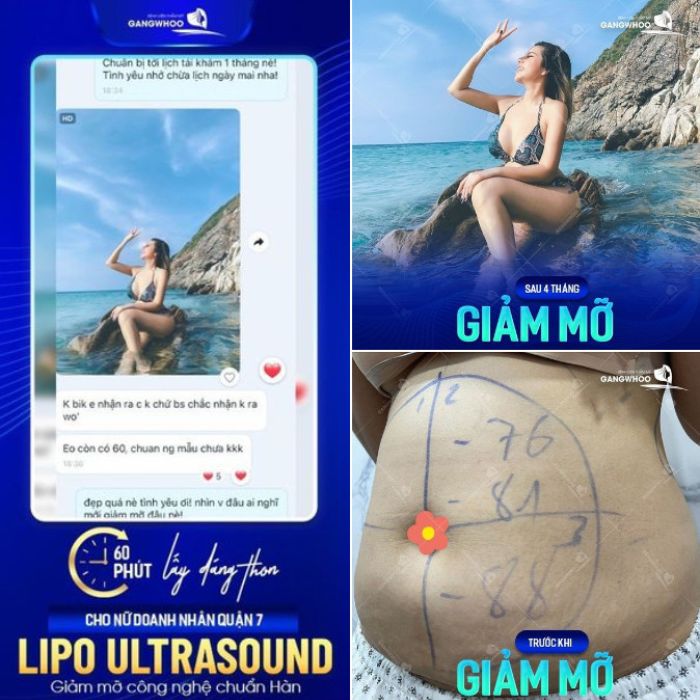 Lipo Ultrasound - Giải pháp hoàn hảo cho vóc dáng thêm quyến rũ