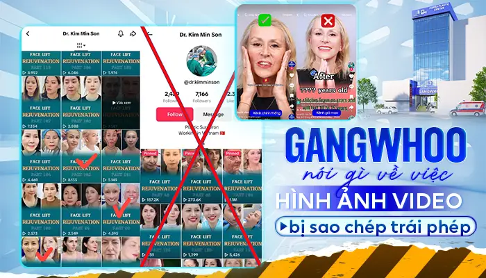 Gangwhoo Nói Gì Về Việc Hình Ảnh Video Bị Sao Chép Trái Phép?