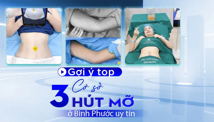 Top 3 Cơ Sở Hút Mỡ Ở Bình Phước Uy Tín