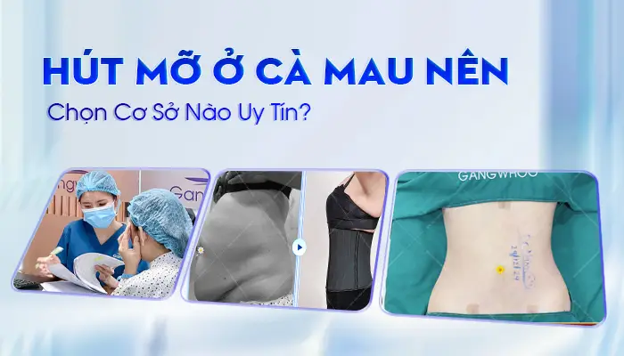 Hút Mỡ Ở Cà Mau Nên Chọn Cơ Sở Nào Uy Tín