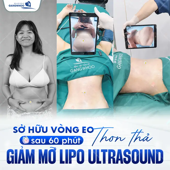 Hút Mỡ Ở Thanh Hóa Cơ Sở Nào An Toàn Và Hiệu Quả?