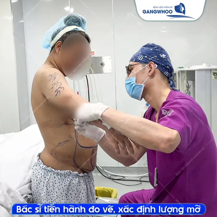 Hút Mỡ Ở Thanh Hóa Cơ Sở Nào An Toàn Và Hiệu Quả?