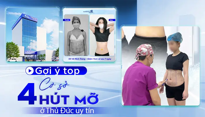 Top 4 Cơ Sở Hút Mỡ Ở Thủ Đức Uy Tín