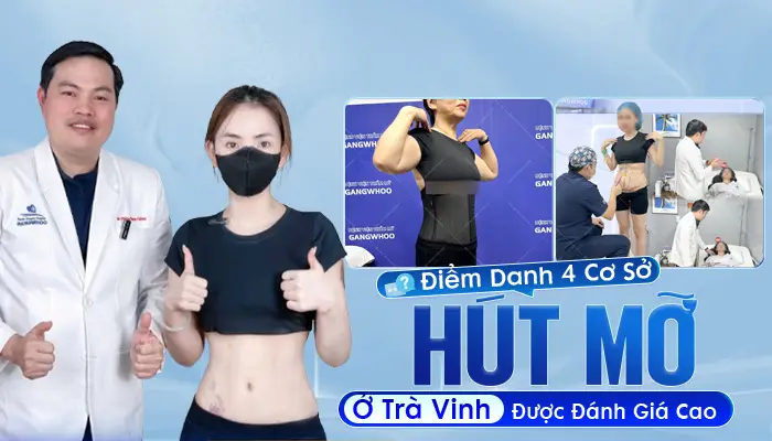 Điểm Danh 4 Cơ Sở Hút Mỡ Ở Trà Vinh Được Đánh Giá Cao