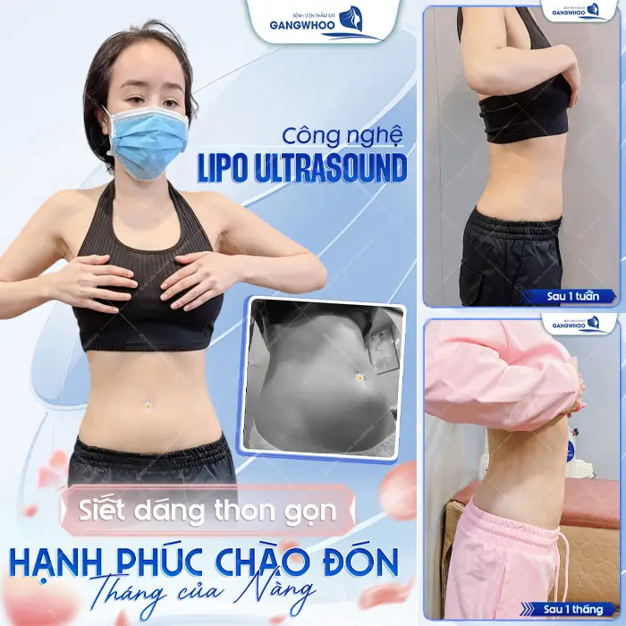 Chọn Đúng Cơ Sở Hút Mỡ Ở Đắk Lắk – Bí Quyết Sở Hữu Dáng Đẹp Không Rủi Ro!