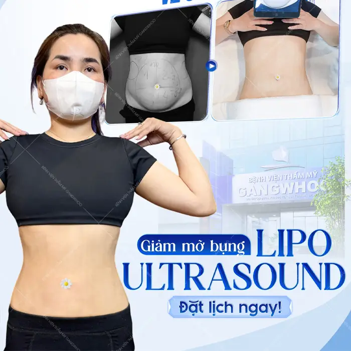 Bí Kíp Đánh Bay Mỡ Thừa – Đâu Là Địa Chỉ Hút Mỡ Ở Thái Nguyên Tốt?